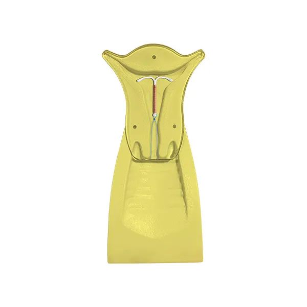 Vertical Uterus Model - Yellow